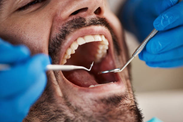 Best Emergency Wisdom Teeth Removal in Los Fresnos, TX
